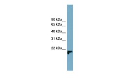 Aviva Systems Biology Corp PRXL2B Antibody - middle region (ARP52921_P050)