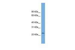 Aviva Systems Biology Corp C5orf24 Antibody - middle region (ARP52950_P050)
