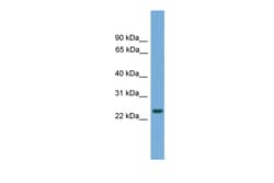 Aviva Systems Biology Corp C19orf18 Antibody - N-terminal region (ARP52994_P050)