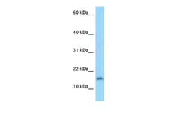 Aviva Systems Biology Corp C3orf22 Antibody - middle region (ARP53027_P050)