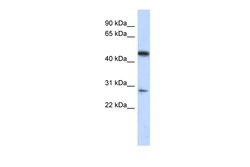 Aviva Systems Biology Corp C13orf31 Antibody - middle region (ARP53139_P050)