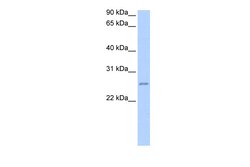 Aviva Systems Biology Corp RPESP Antibody - C-terminal region (ARP53141_P050)