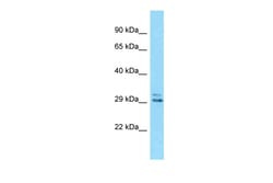 Aviva Systems Biology Corp Eid2 Antibody - C-terminal region (ARP53146_P050)