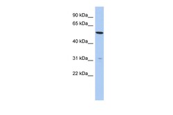 Aviva Systems Biology Corp TMEM161B Antibody - N-terminal region (ARP53168_P050)