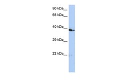 Aviva Systems Biology Corp C10orf46 Antibody - middle region (ARP53203_P050)