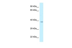 Aviva Systems Biology Corp Rdh10 Antibody - C-terminal region (ARP53217_P050)