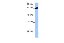 Aviva Systems Biology Corp C19orf21 Antibody - C-terminal region (ARP53237_P050)