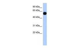 Aviva Systems Biology Corp MPP7 Antibody - N-terminal region (ARP53247_P050)