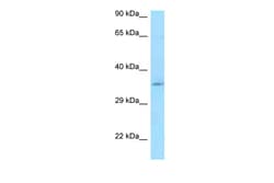Aviva Systems Biology Corp CCDC117 Antibody - middle region (ARP53255_P050)