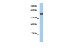 Aviva Systems Biology Corp SLC38A9 Antibody - middle region (ARP53259_P050)