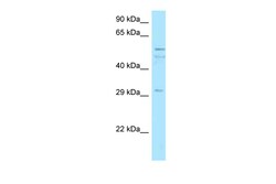 Aviva Systems Biology Corp C11orf42 Antibody - C-terminal region (ARP53268_P050)
