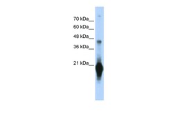 Aviva Systems Biology Corp C17orf49 Antibody - middle region (ARP53291_P050)
