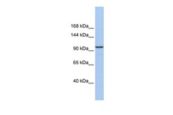 Aviva Systems Biology Corp KLB Antibody - middle region (ARP53325_P050)
