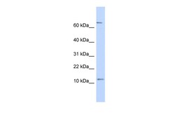Aviva Systems Biology Corp TRA16 Antibody - N-terminal region (ARP53343_P050)