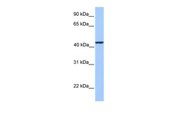 Aviva Systems Biology Corp KLC3 Antibody - middle region (ARP53346_P050)