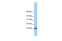Aviva Systems Biology Corp TRAPPC6B Antibody - middle region (ARP53348_P050)