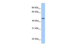 Aviva Systems Biology Corp ASB6 Antibody - middle region (ARP53352_P050)
