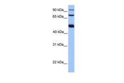 Aviva Systems Biology Corp WDR49 Antibody - C-terminal region (ARP53377_P050)