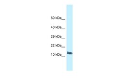Aviva Systems Biology Corp Morn4 Antibody - C-terminal region (ARP53381_P050)