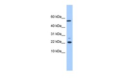 Aviva Systems Biology Corp DPH4 Antibody - N-terminal region (ARP53399_P050)