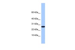 Aviva Systems Biology Corp RFLNA Antibody - middle region (ARP53404_P050)