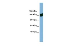 Aviva Systems Biology Corp AASDH Antibody - middle region (ARP53414_P050)