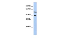 Aviva Systems Biology Corp PHACTR3 Antibody - C-terminal region (ARP53447_P050)