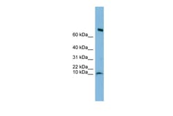 Aviva Systems Biology Corp C1orf122 Antibody - N-terminal region (ARP53467_P050)