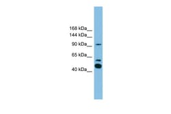 Aviva Systems Biology Corp PLA2G4E Antibody - C-terminal region (ARP53548_P050)