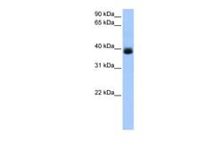 Aviva Systems Biology Corp SERPINA5 Antibody - C-terminal region (ARP53555_P050)