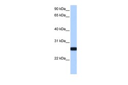 Aviva Systems Biology Corp IL13RA2 Antibody - N-terminal region (ARP53557_P050)