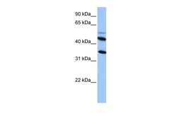 Aviva Systems Biology Corp IL13RA2 Antibody - middle region (ARP53558_P050)