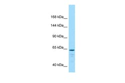 Aviva Systems Biology Corp LOC100362123 ANTIBODY 50UG/50U, Quantity: Each