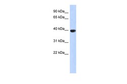 Aviva Systems Biology Corp AURKC Antibody - middle region (ARP53575_P050)