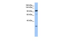 Aviva Systems Biology Corp AP2B1 Antibody - C-terminal region (ARP53577_P050)