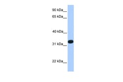Aviva Systems Biology Corp ACRV1 Antibody - N-terminal region (ARP53590_P050)