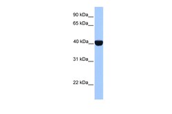 Aviva Systems Biology Corp CSNK2A2 Antibody - C-terminal region (ARP53595_P050)