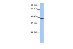 Aviva Systems Biology Corp CSNK2A2 Antibody - C-terminal region (ARP53596_P050)