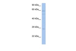Aviva Systems Biology Corp PRKAA1 Antibody - middle region (ARP53652_P050)