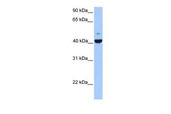 Aviva Systems Biology Corp FGFR1OP Antibody - N-terminal region (ARP53669_P050)
