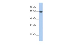 Aviva Systems Biology Corp FEM1B Antibody - C-terminal region (ARP53703_P050)