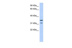 Aviva Systems Biology Corp C17orf81 Antibody - middle region (ARP53704_P050)
