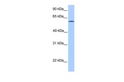 Aviva Systems Biology Corp ACSBG2 Antibody - middle region (ARP53793_P050)