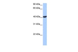 Aviva Systems Biology Corp PGK2 Antibody - C-terminal region (ARP53820_P050)