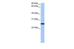 Aviva Systems Biology Corp CCDC46 Antibody - C-terminal region (ARP53824_P050)