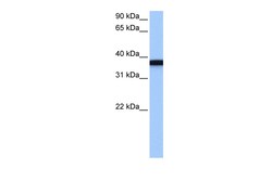 Aviva Systems Biology Corp GSG1 Antibody - C-terminal region (ARP53835_P050)