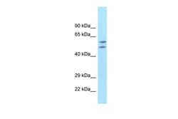 Aviva Systems Biology Corp ATG16L1 Antibody - middle region (ARP54269_P050)
