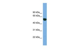 Aviva Systems Biology Corp EPHX1 Antibody - N-terminal region (ARP54285_P050)