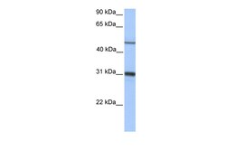 Aviva Systems Biology Corp EPHX1 Antibody - middle region (ARP54286_P050)