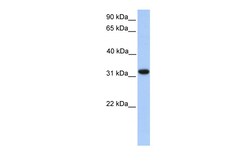 Aviva Systems Biology Corp ETFA Antibody - N-terminal region (ARP54289_P050)
